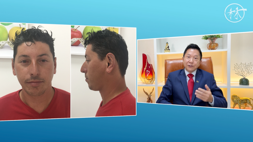 Descubra com Milton Seigi Hayashi por que os bioestimuladores de colágeno são tendência para rejuvenescimento.